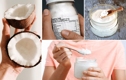Kokosovo ulje – super namirnica ili super mit